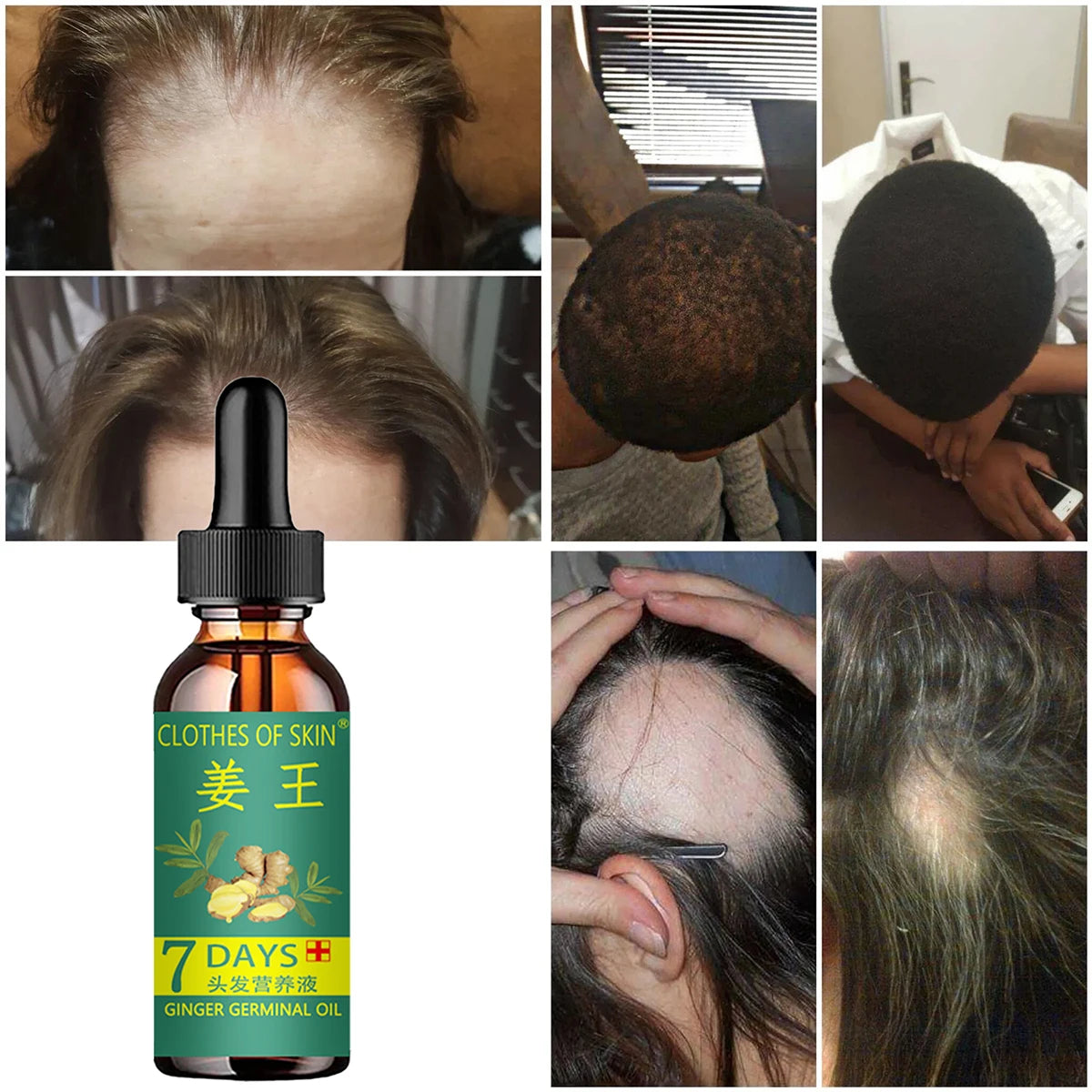 Natural Loss Treatment Oil Hair Care