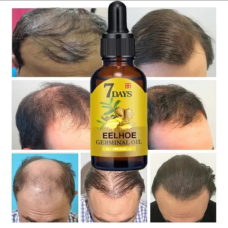 7 Day Fast Hair Growth Oil